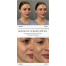 REJURAN SkinGlow Cushion SPF50+ 15g Reffil – Мультифункціональний кушон з полінуклеотидами (рефіл) - фото №2 REJURAN SkinGlow Cushion SPF50+ 15g Reffil – Мультифункціональний кушон з полінуклеотидами (рефіл) - фото №2