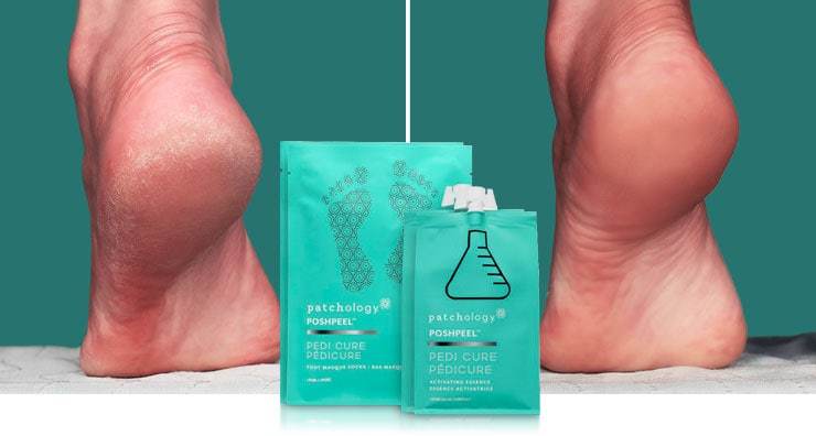 Patchology Відлущуючий пілінг для ніг PoshPeel ™ Pedi Cure - фото №1