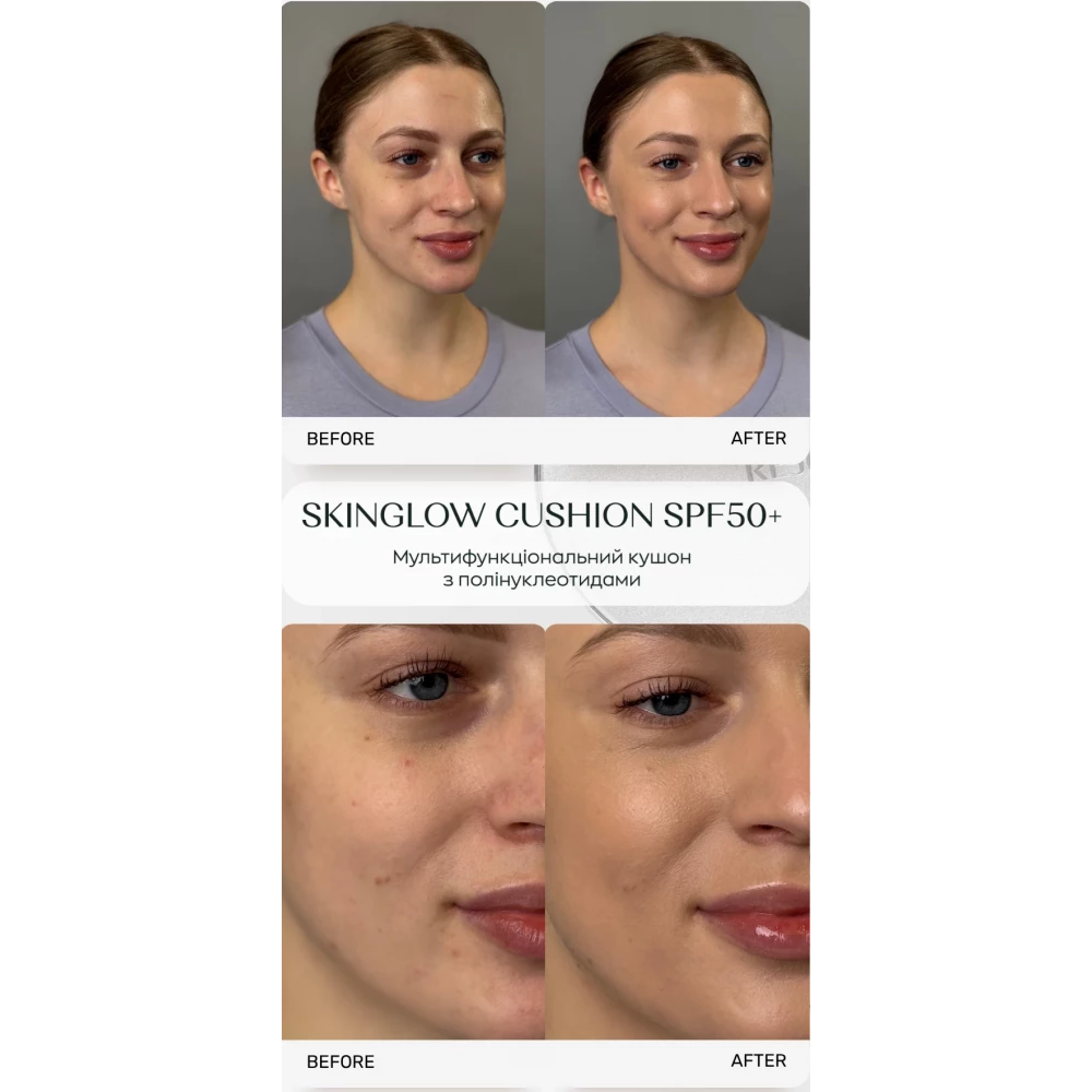 REJURAN SkinGlow Cushion SPF50+ 15g Reffil – Мультифункціональний кушон з полінуклеотидами (рефіл) - фото №2 REJURAN SkinGlow Cushion SPF50+ 15g Reffil – Мультифункціональний кушон з полінуклеотидами (рефіл) - фото №2